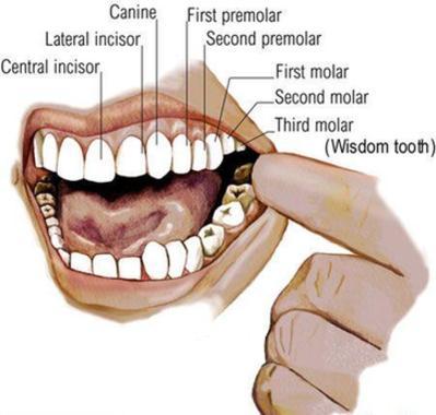 Wisdom Tooth