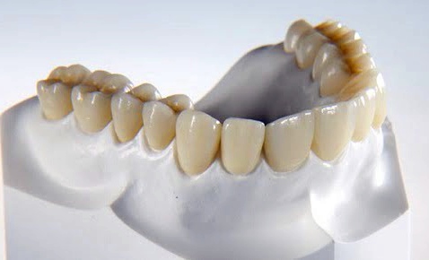 dental zirconia cosmetic restoration