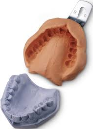 Alginate dental duplication