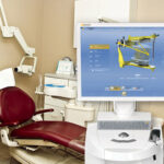 3D CAD-CAM dental prosthesis