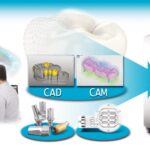 cad-cam dentistry system