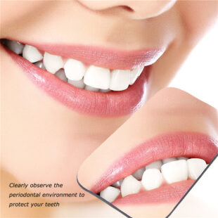 Dental Intraoral Mirror orthodontic treatment effect