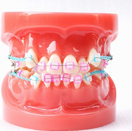 Orthodontic educational models