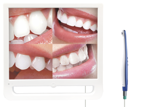 4 picture display camera intraoral dental equipment with screen