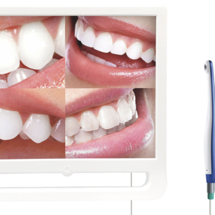 4 picture display camera intraoral dental equipment with screen