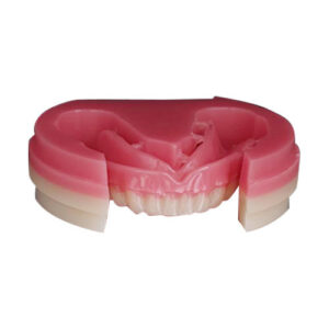 complete dentures fabricated by cad cam pmma