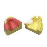 Alveolar Bone Graft Simulation Model