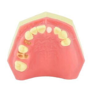 Maxillary Exodontia Simulation Model