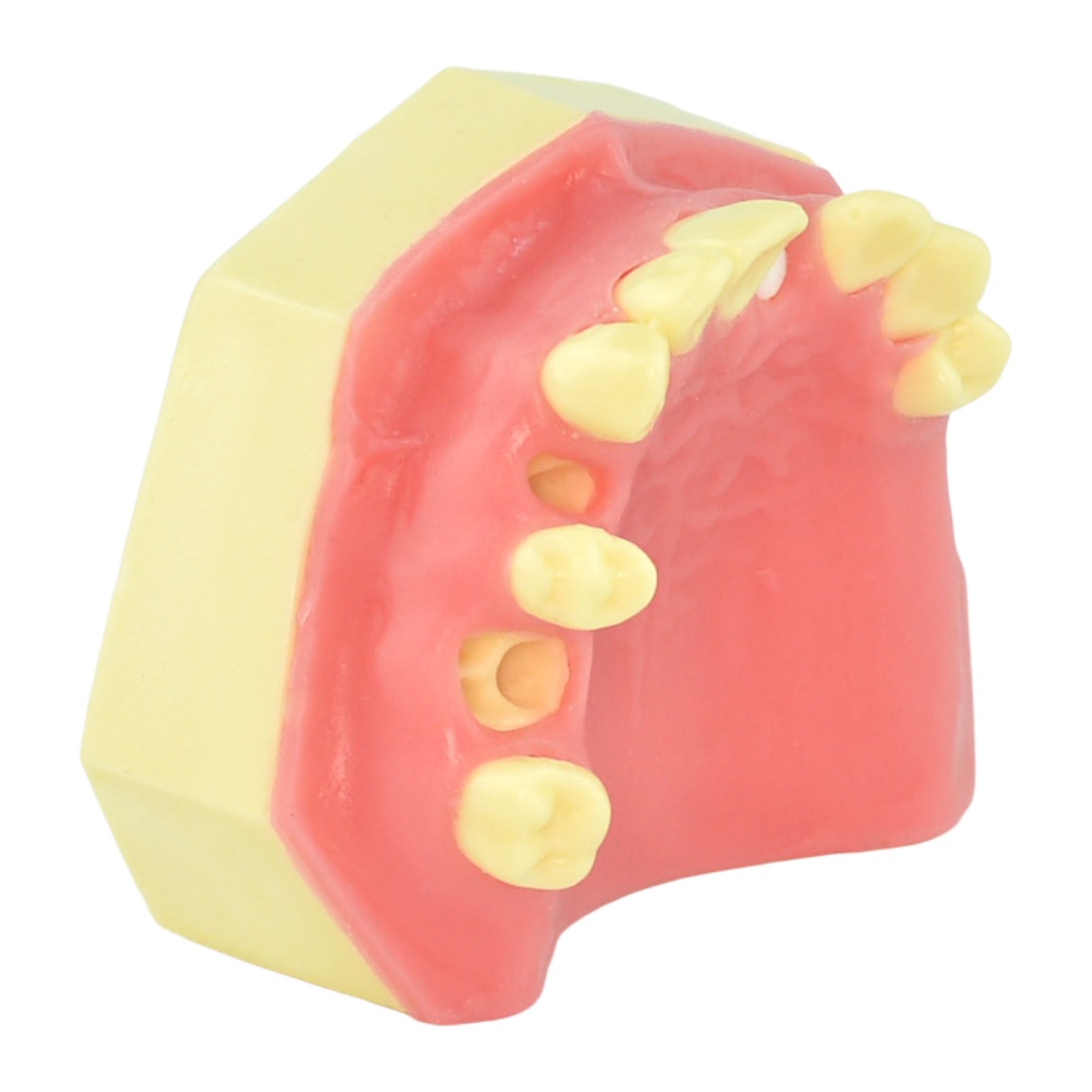 Maxillary Partial Dentition Surgical Extraction Practice Model