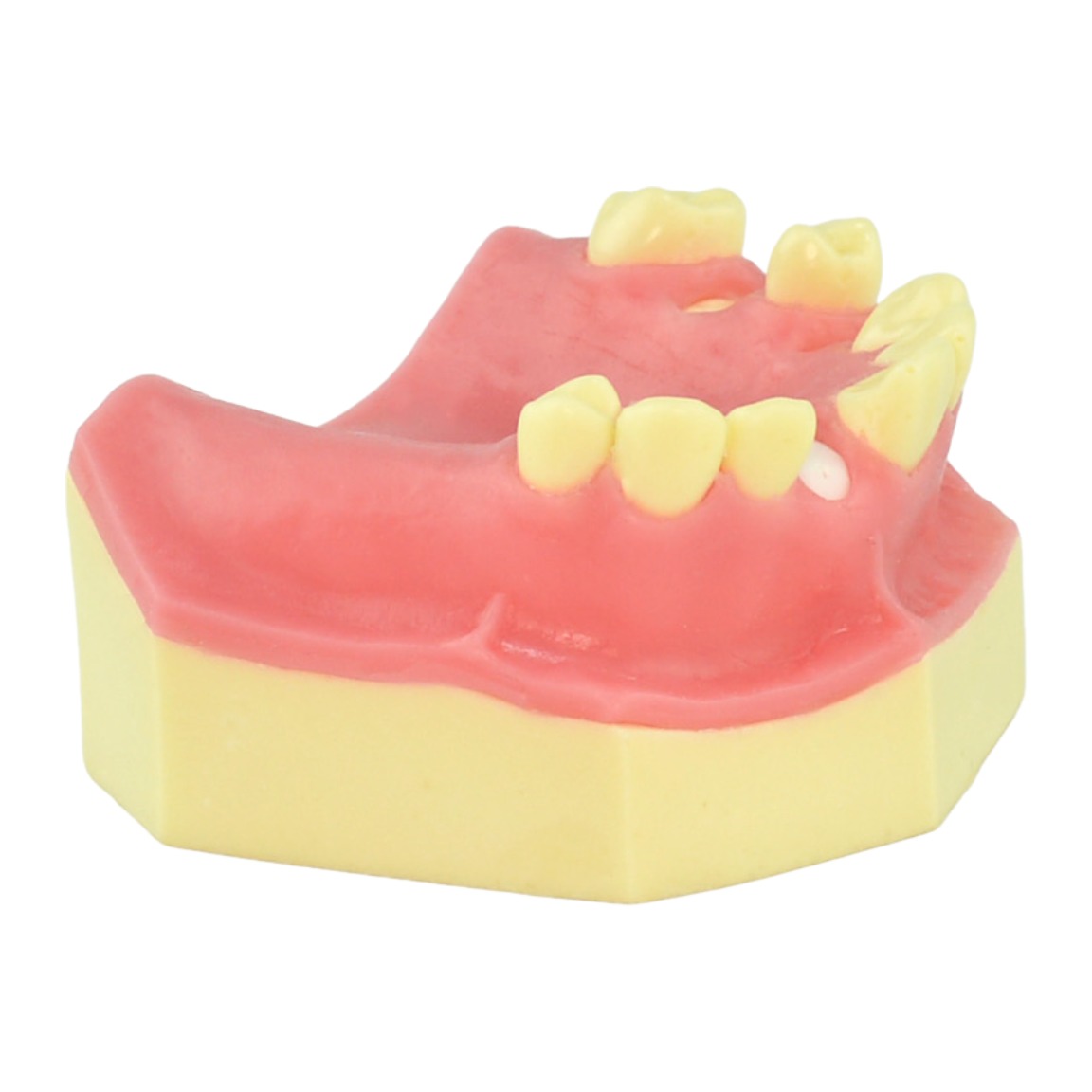Maxillary Retained Root Removal Simulation Typodont