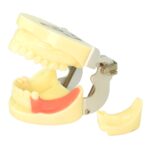 Phantom Head with Implant Module