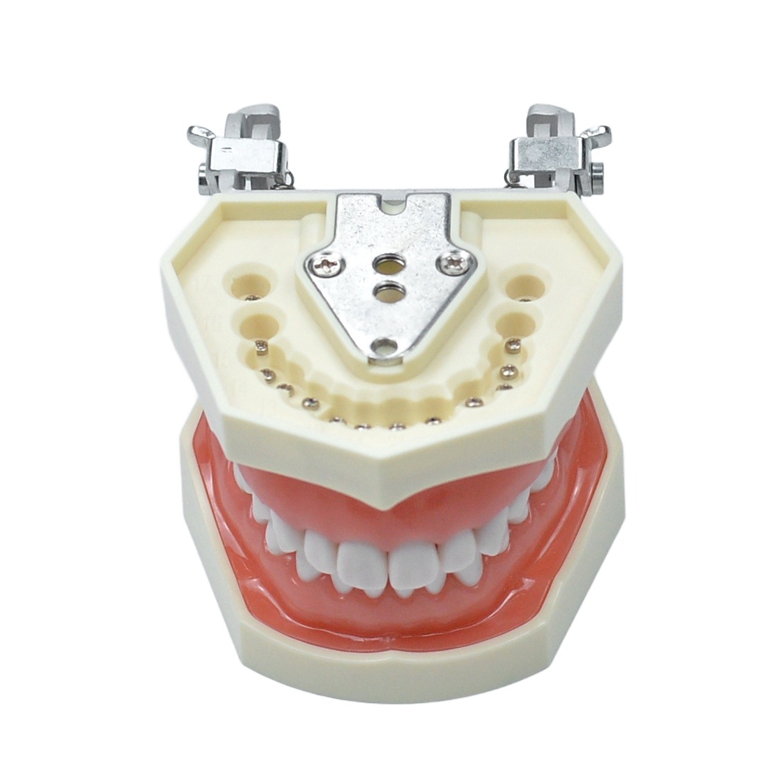 Screw-retained and placement available design