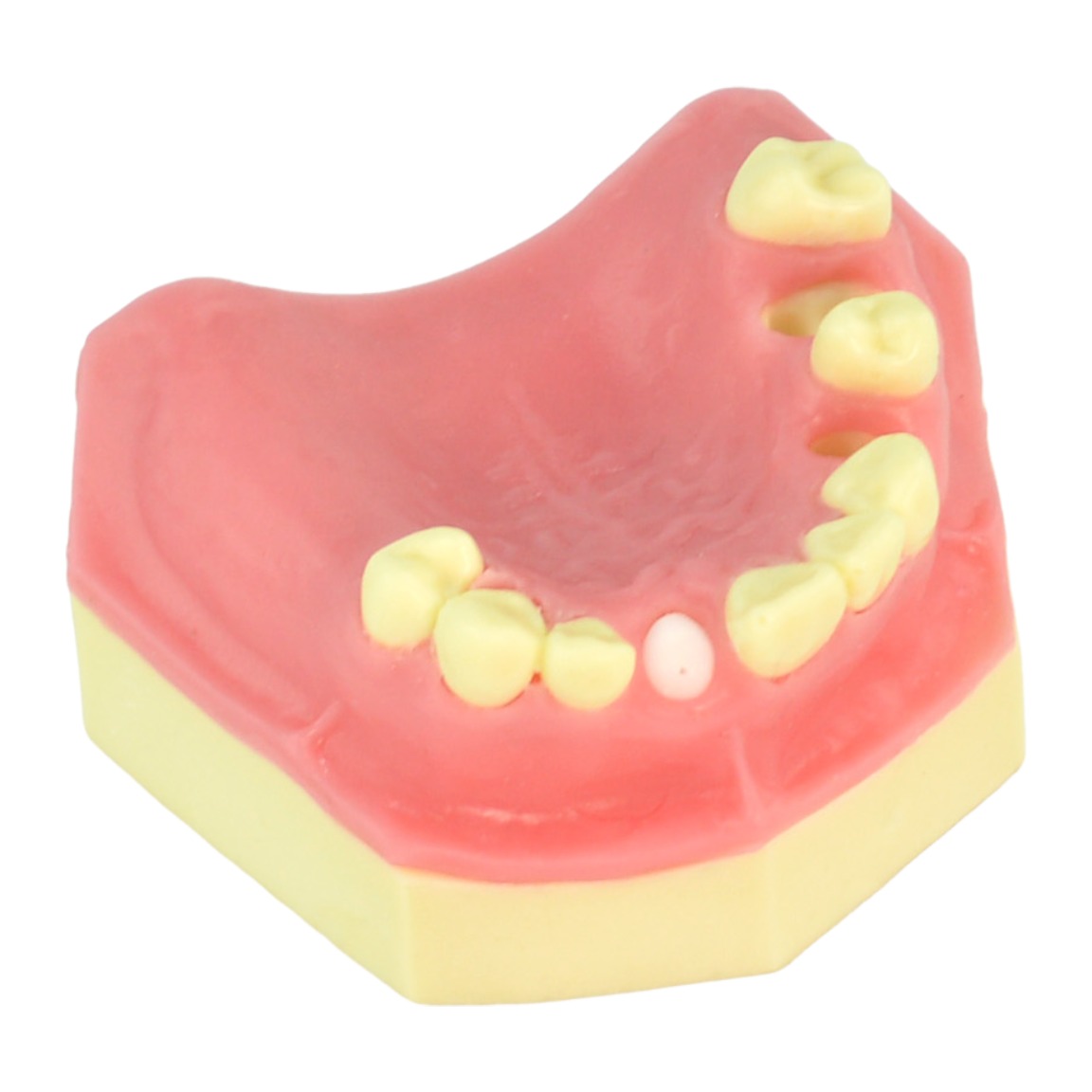 Maxillary Residual Root Extraction Model - Image 2