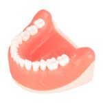 horizontally wisdom tooth embed in typodont jaw model