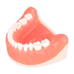horizontally wisdom tooth embed in typodont jaw model