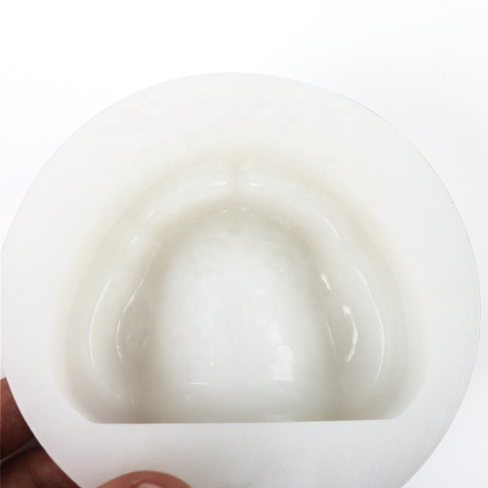 Smooth ridge impression for complete edentulous arch duplication die stone model